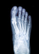 x-ray film