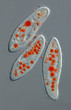 Paramecium caudatum - gefüttert mit gefärbten Hefezellen - DIC