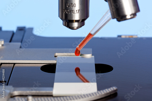 Foto: Microscope and blood sample Microscope and blood sample
