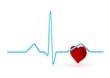 Ekg - heart monitor