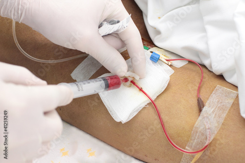 Photo: taking arterial blood samples. photo. taking arterial blood samples. photo.