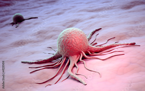 Illustration: Cancer cell scientific illustration Cancer cell scientific illustration