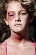 Domestic violence