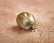 Tick