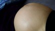 Pregnant woman