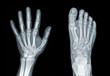 Photo: Roentgenogram Roentgenogram