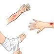 Photo en ligne au meilleur prix first aid injuries illustration