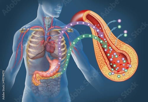 Illustration: Types of diabetes Types of diabetes
