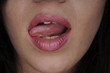 Lippen