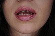 Lippen