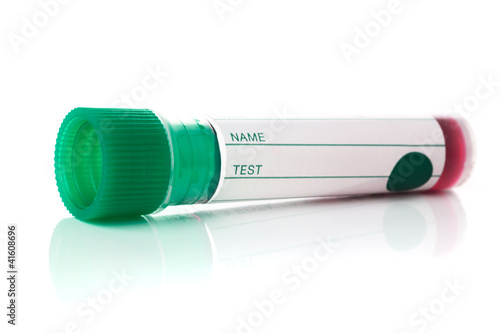 Photo: Test tube Test tube