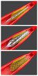 Illustration: Angioplasty Angioplasty