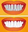 Beautiful young woman teeth before and after whitening.