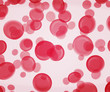 Foto: Hemoglobin Texture Hemoglobin Texture