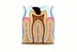 Video: dental Implant dental Implant