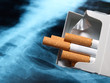 Lung and cigarettes