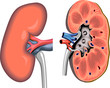 kidney