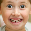 Boy smiling without one teeth