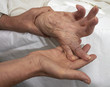 Arthritic Hand