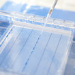 Photo: loading a sample into a gel for electrophoresis loading a sample into a gel for electrophoresis