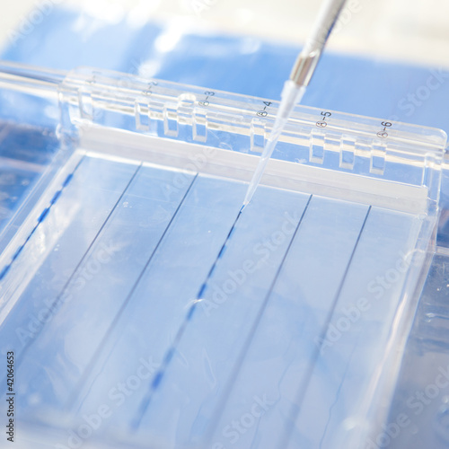Photo: loading a sample into a gel for electrophoresis loading a sample into a gel for electrophoresis