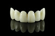 Dental tooth bridge