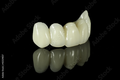 Photo: Dental Bridge Dental Bridge