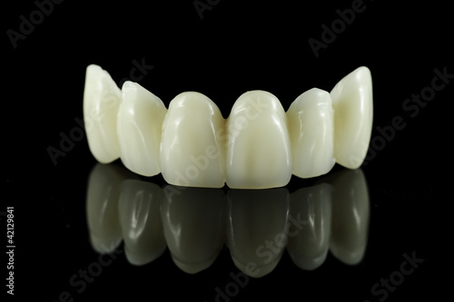 Photo: Dental tooth bridge Dental tooth bridge