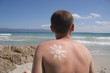 Sonnenbrand