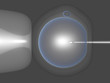 Illustration: ICSI - Intrazytoplasmatische Spermieninjektion ICSI - Intrazytoplasmatische Spermieninjektion