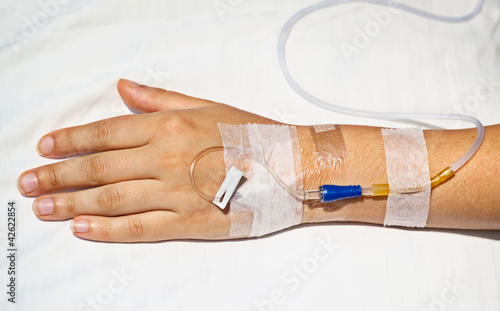 Photo: Medical intravenous cannula on hand Medical intravenous cannula on hand