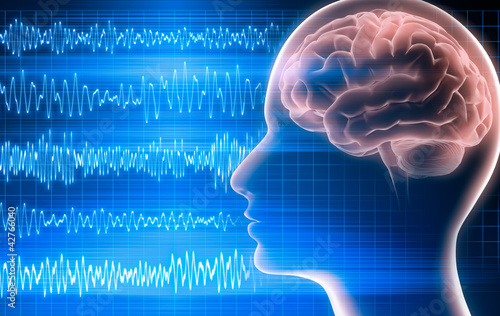 Illustration: EEG 3 EEG 3