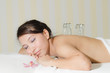 asian woman laying on chest with cupping treatment on bac