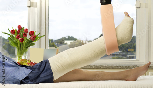 Photo: Broken Leg Broken Leg