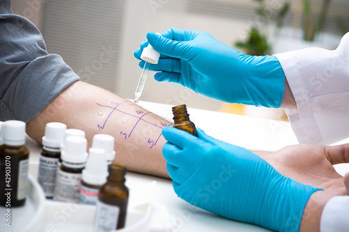 Foto: Skin prick allergy test Skin prick allergy test