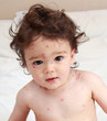 Baby suffering with chicken pox