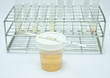 urine for testing in laboratory for diagnosis disease