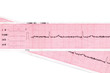 Heart. Cardiogram