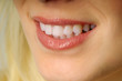 Beautiful smile