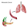 Cancer spreads through blood circulation, eps8