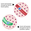 Cancer cell squeezes through blood and lymph vessel