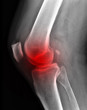X-ray knee