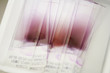 Close up of blood on medical slides