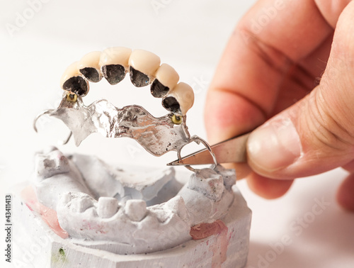 Photo: Metal Ceramic Bridge Metal Ceramic Bridge