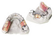 Plaster cast of  teeth and dentures
