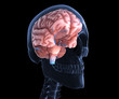 Human Brain X-ray