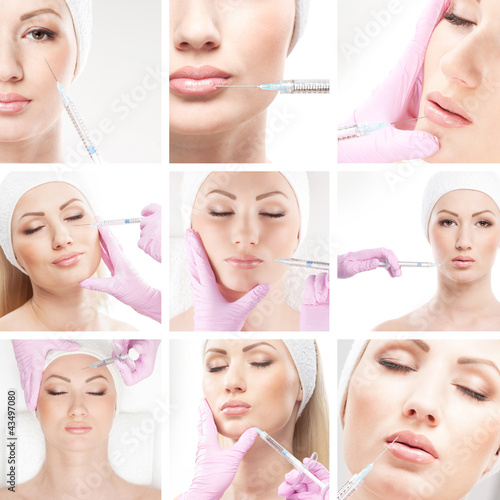 Photo: A collage of images with young woman on a botox procedure A collage of images with young woman on a botox procedure