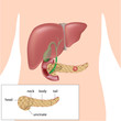 Pancreatic cancer, eps10