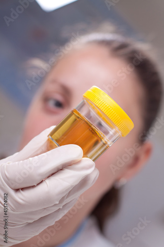 Photo: Woman examine urine container Woman examine urine container