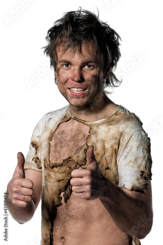 Foto: Burnt man Burnt man